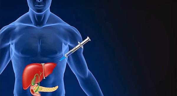 phuong-phap-moi-chua-benh-tieu-duong